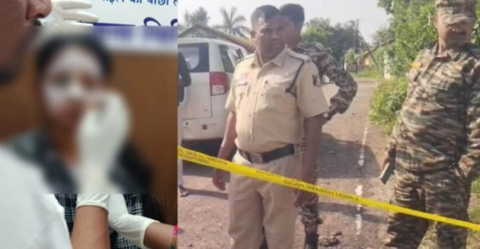 Acid attack on 22-year-old woman in Balod; police searching for unidentified attacker